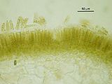 Colpomenia sinuosa4